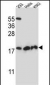DHFRL1 Antibody (Center)